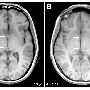 commissure.gif